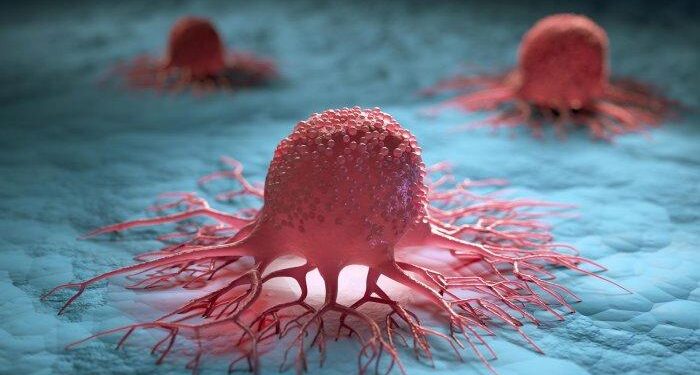 Hari Kanker Sedunia 2026: 400 Ribu Kasus Baru di Indonesia, Pencegahan dan Deteksi Dini Jadi Kunci Tekan Angka Kematian